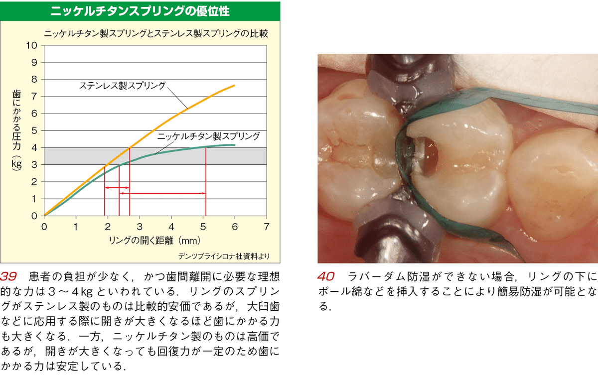 須崎 明・著『そうだったのか！ CR修復』より―やりたくないのに