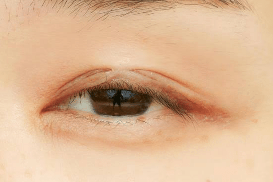 一重の僕が二重になれた方法 1 Kou 習慣化の人 Note