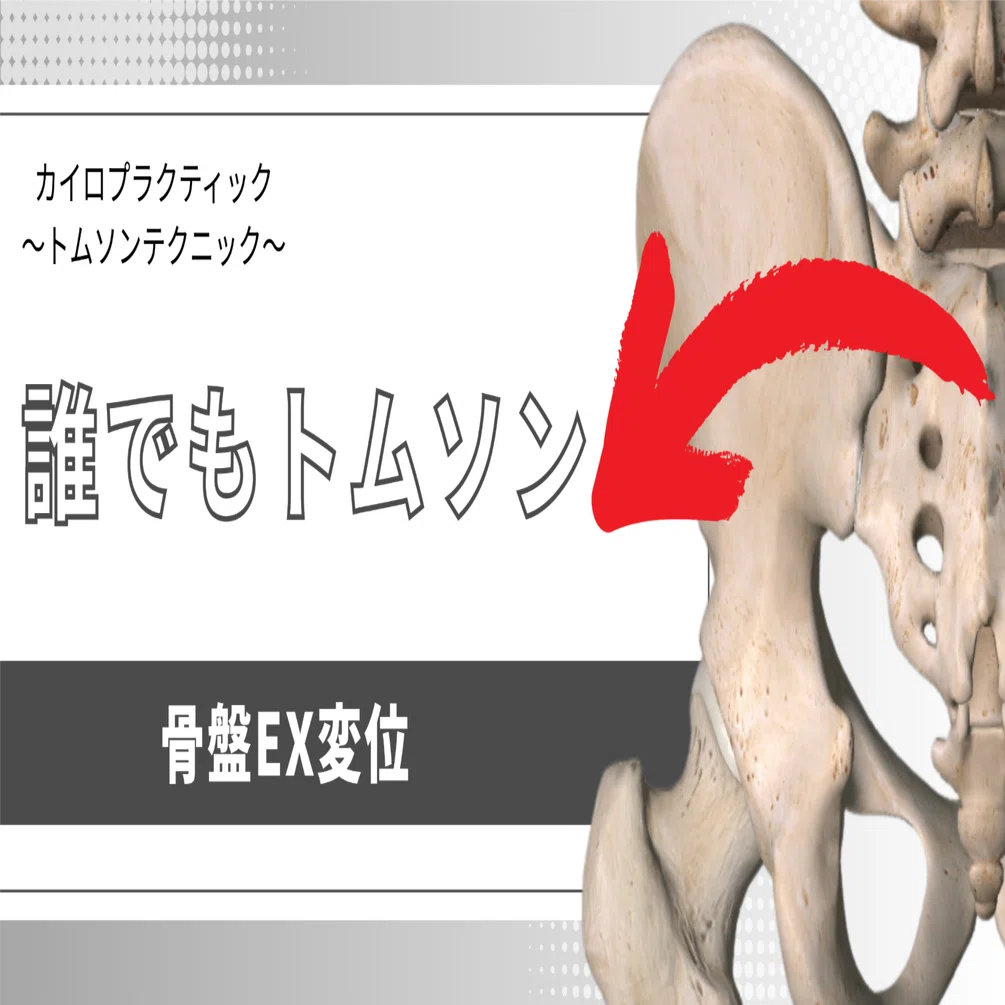 M117 トムソンテクニックマニュアル　カイロプラクティック　トムソンテクニック カイロプラクティック/トムソンテクニック「骨盤EX変位」｜Doctor of