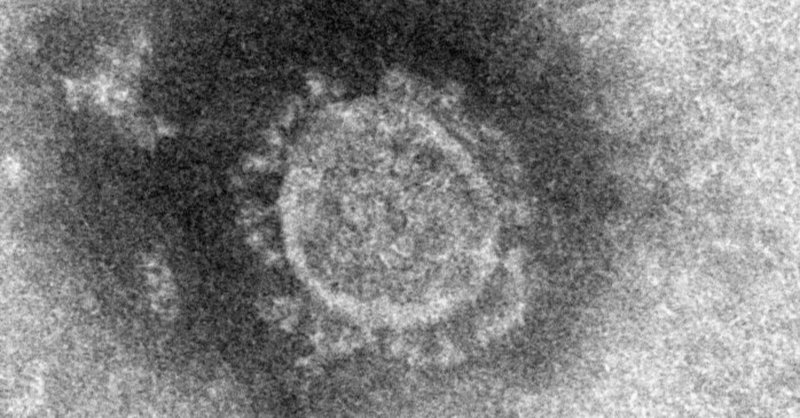 Coronavirus COVID-19の分布