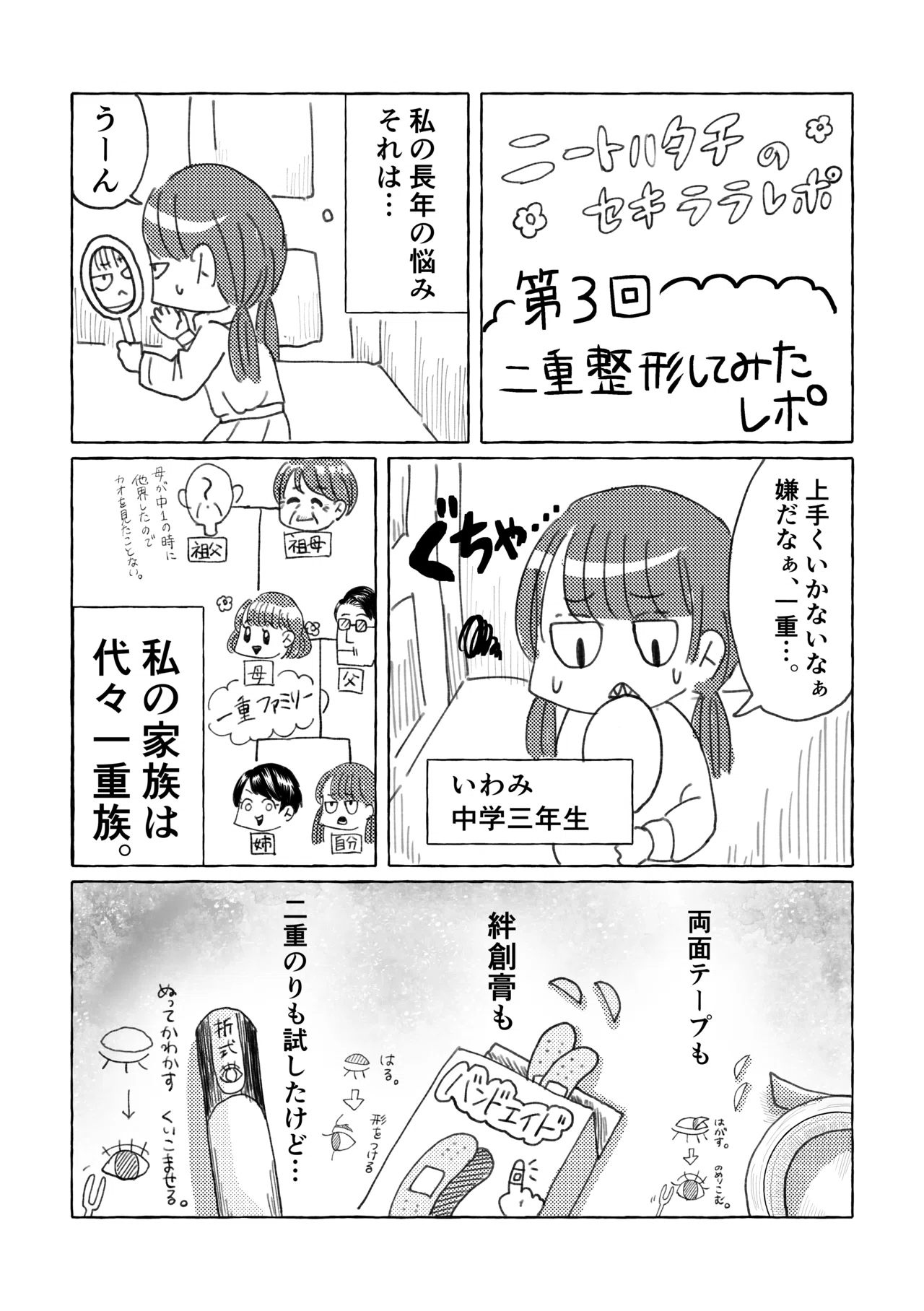 二重整形してみたレポ いわみ Note