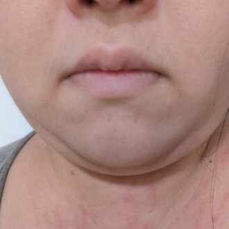 おいはる※noteエッセイスト駆け出し(コミュ障・陰キャあり)