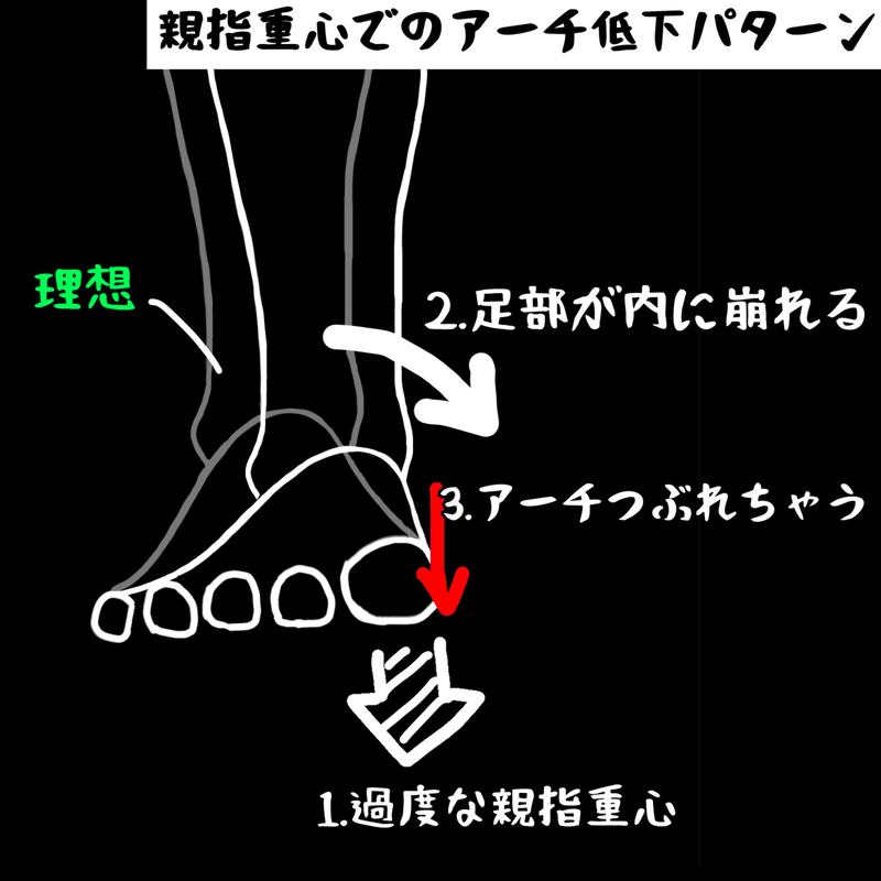 扁平足 土踏まずが痛い時はこの流れでトレーニングしてみて みつやま 宿題エクササイズ公開中 Note 扁平足 土踏まずが痛い時はこの流れでトレーニングしてみて みつやま 宿題エクササイズ公開中 Note