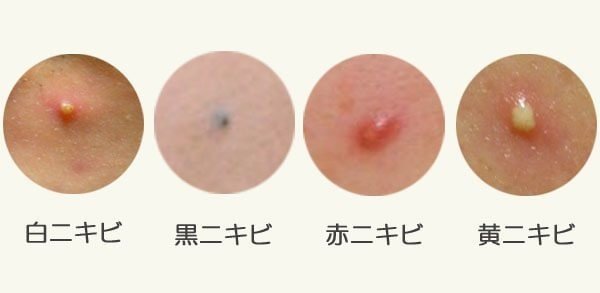 アイドルのビキニ画像 5着目 YouTube動画>27本 ニコニコ動画>1本 ->画像>1031枚 