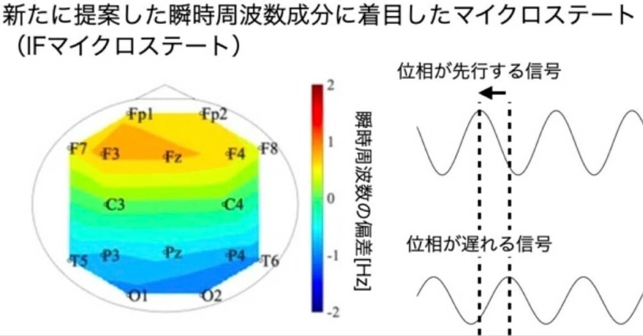 脳波からアルツハイマー病の特徴をとらえる - 「瞬時周波数マイクロ