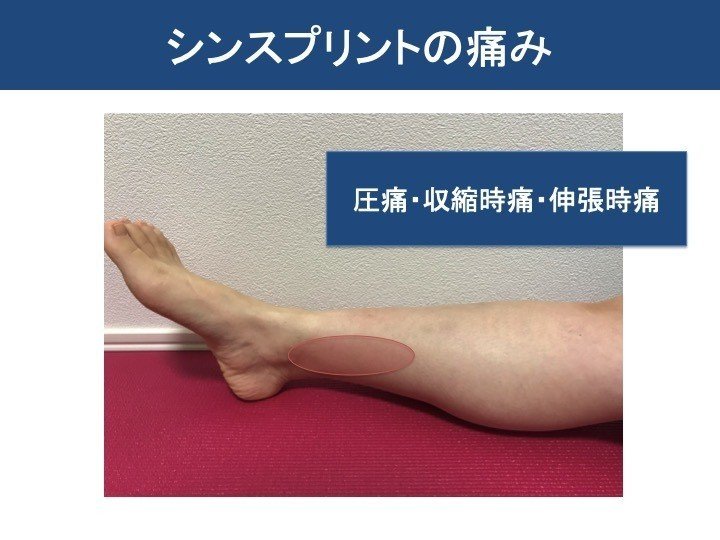 シンスプリントを紐解く機能評価から動作分析 岡野 良介 Note シンスプリントを紐解く機能評価から動作分析 岡野 良介 Note