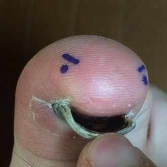 祖父の死 4 通夜 葬式 アズール Note