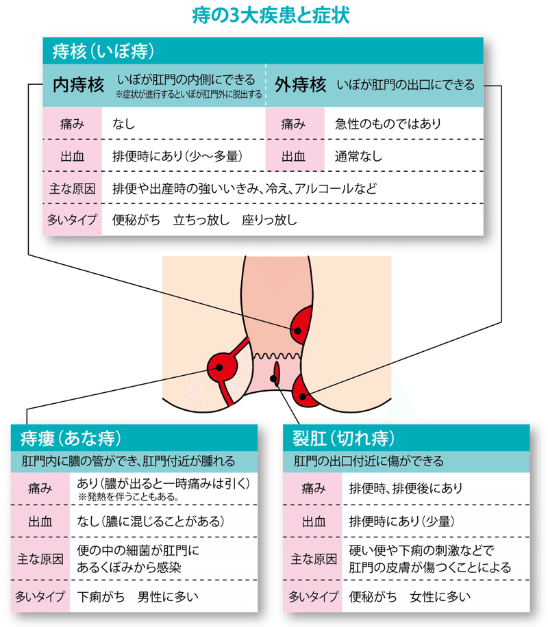 お尻の話について 宮古島のきわめて健康コラム Vol 64 あるお薬屋さんのひとりごと Note