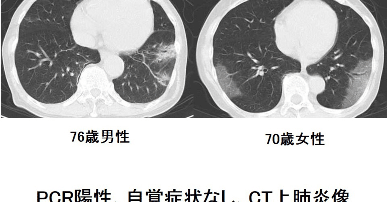 サイレント肺炎 症状のない新型コロナウイルスの特徴 文京区根津 似鳥クリニック Note