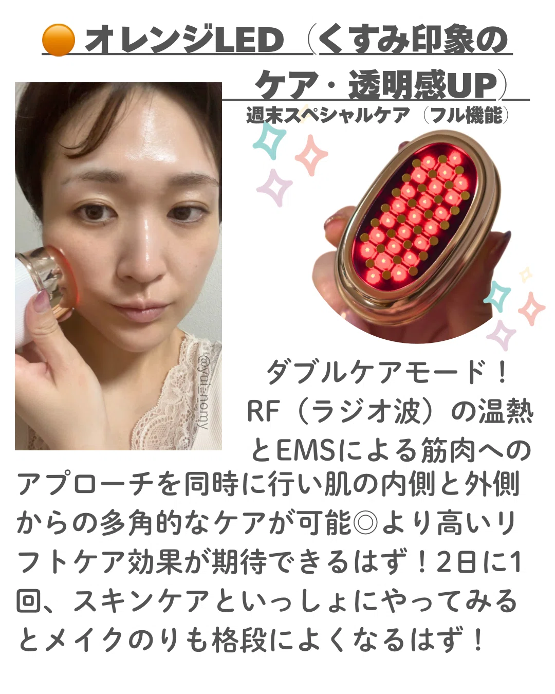 ANLAN ミニRF美顔器レビュー！｜yui_nomy