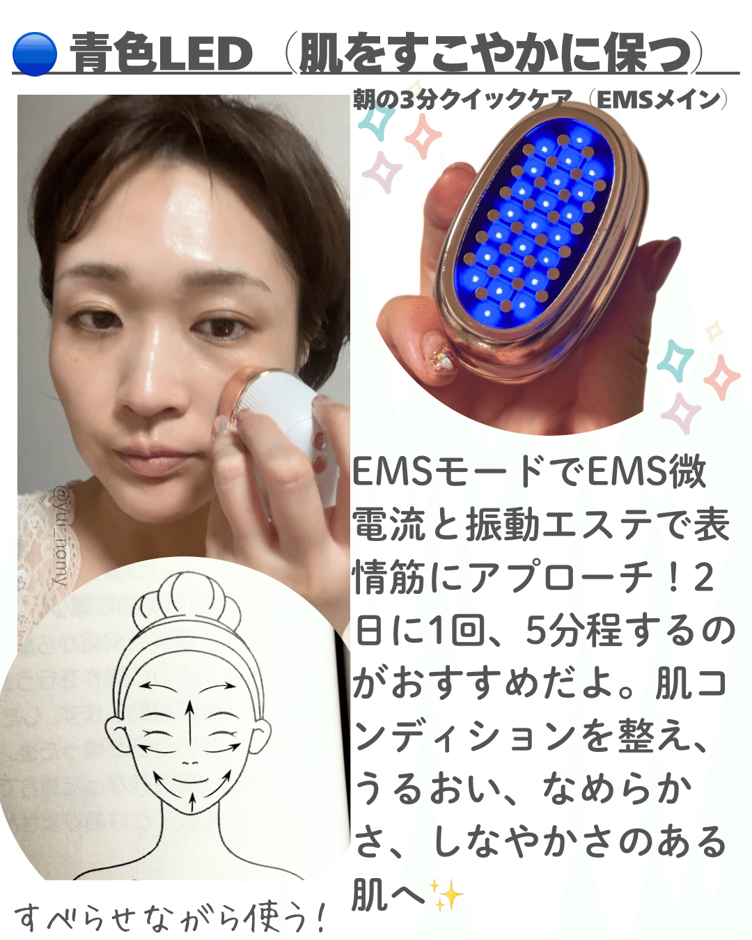 ANLAN ミニRF美顔器レビュー！｜yui_nomy