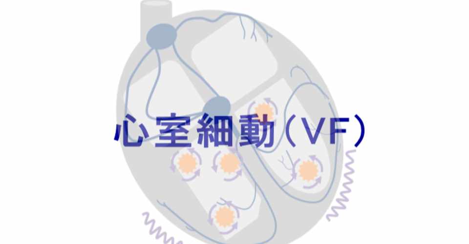 心電図イラスト 心室細動 Vf Ceme Jpeg Note