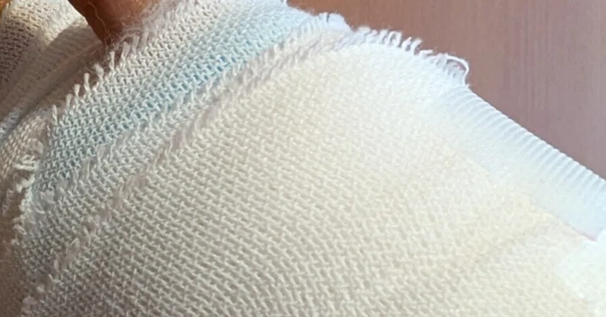 #262 [Panic Disorder] 2 Weeks Post-Tenosynovitis Surgery｜♥ゆんパニ♥