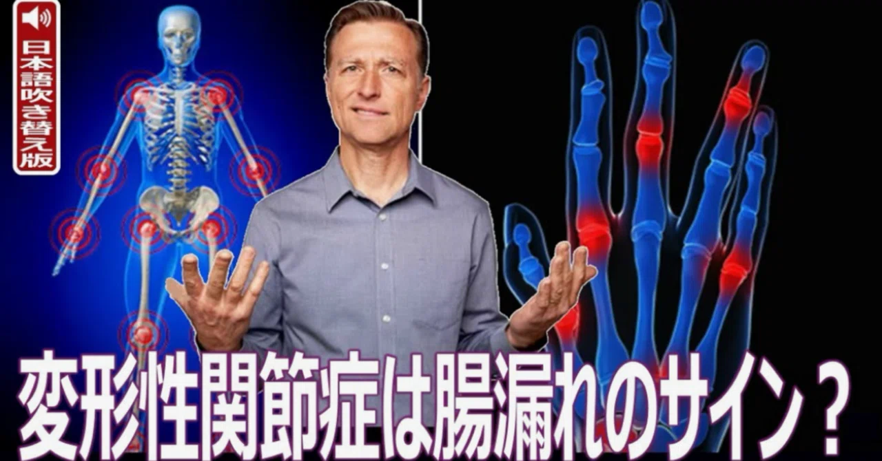 最新｜変形性関節症は腸漏れのサイン？ ― お薦め野菜１つ｜ドクター・バーグ