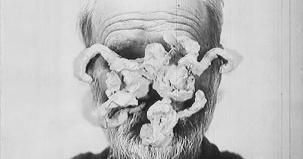 ヤン・シュヴァンクマイエル｜S (Varelser)