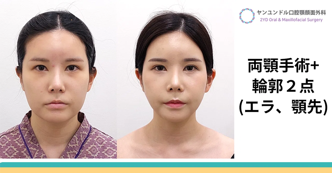 裁断済 コンパス 顔面骨の整美と治療 【公式通販】