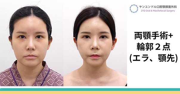 コンパス 顔面骨の整美と治療 裁断済⭐︎ 裁断済】コンパス 顔面骨