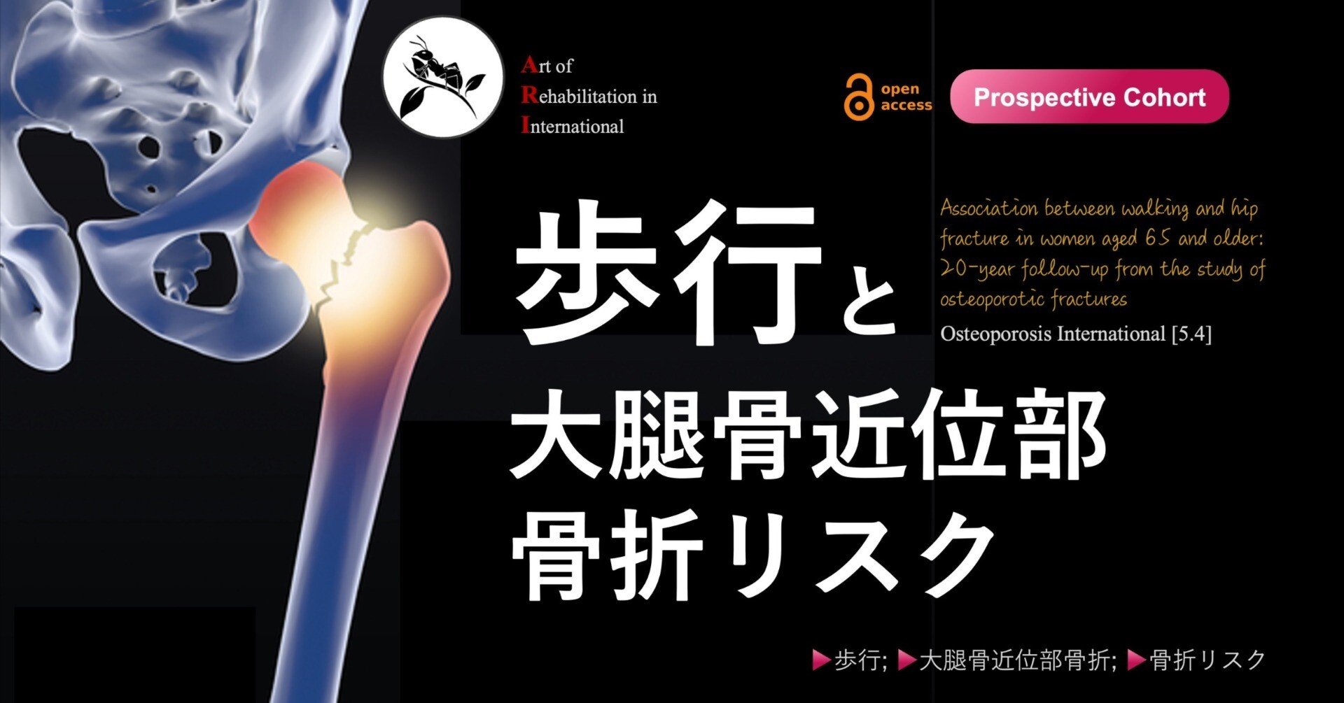 歩行と大腿骨近位部骨折リスク｜Super Human | 理学療法士／保健学博士