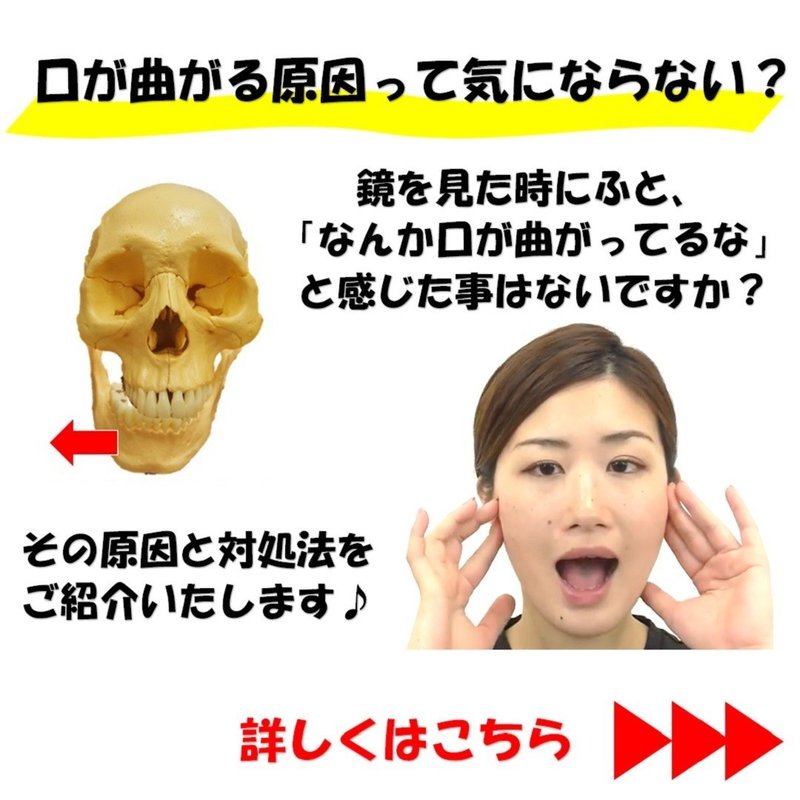 口が曲がる原因って気にならない 下顎の歪みを治す矯正セルフケア３選 Revisionginza Note