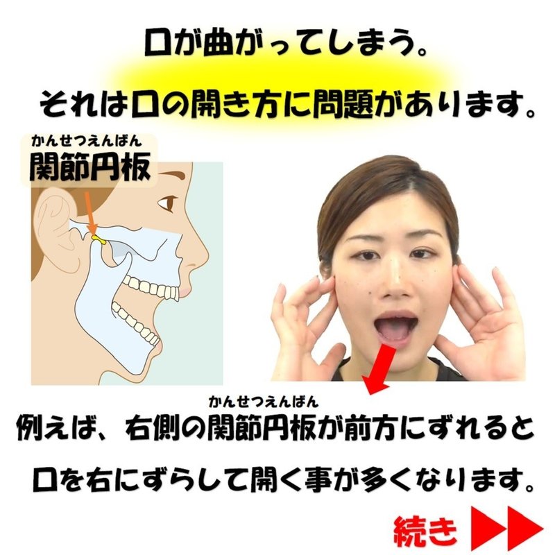 口が曲がる原因って気にならない 下顎の歪みを治す矯正セルフケア3選 Revisionginza Note 口が曲がる原因って気にならない 下顎の歪みを治す矯正セルフケア3選 Revisionginza Note