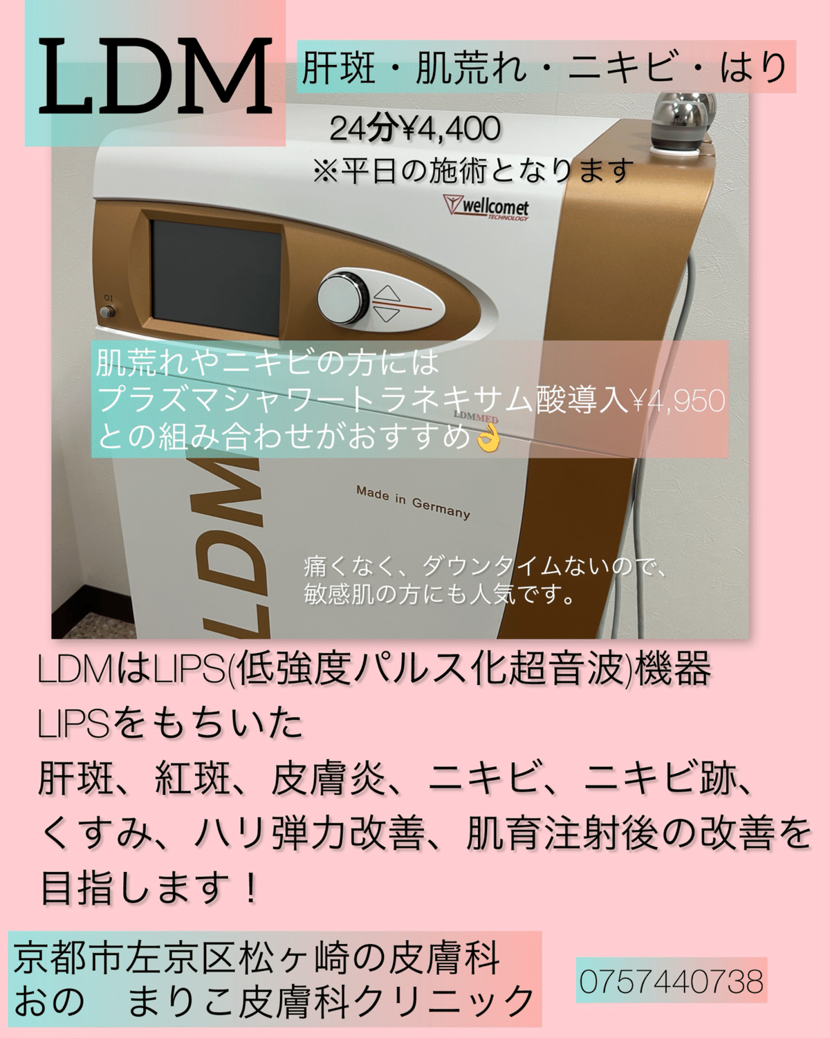 LDM ニキビ 肝斑 肌育注射のあとにプラズマシャワートラネキサム酸導入