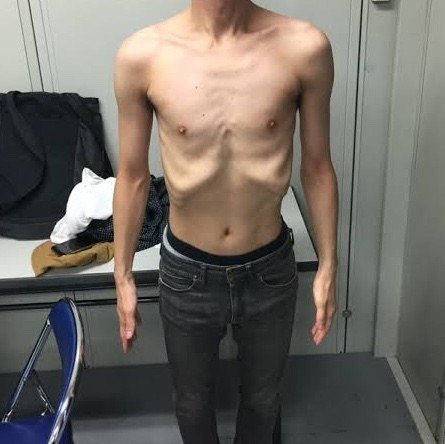 腹筋を割る 前編 理論編 きょうかい Note