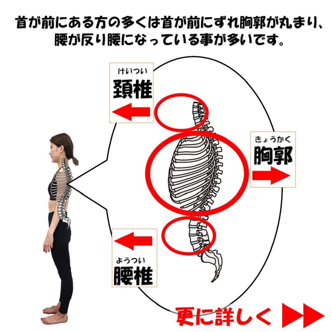 首が前に出ちゃう 首だけ治しても治らない理由と自分で出来る矯正体操 Revisionginza Note 首が前に出ちゃう 首だけ治しても治らない理由と自分で出来る矯正体操 Revisionginza Note