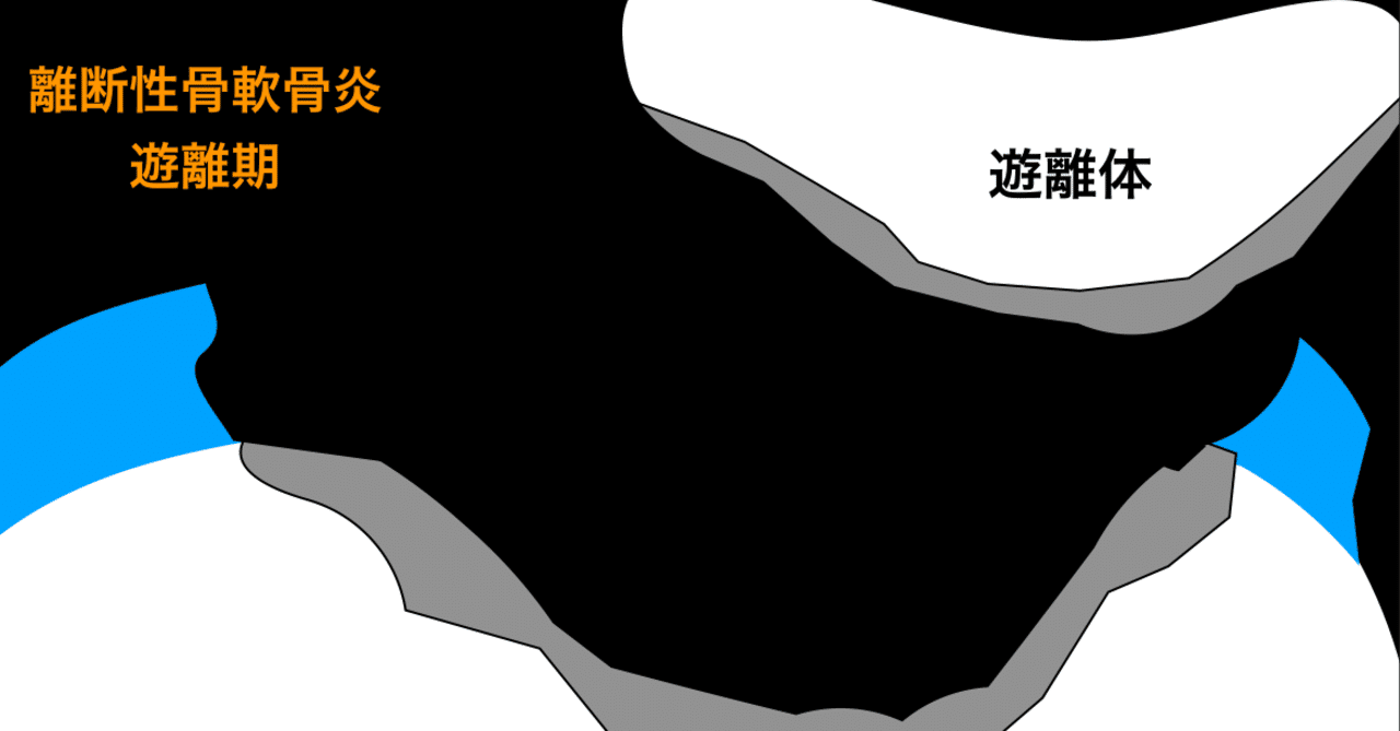野球少年を襲う病魔 痛くない野球肘がある Part5 吉田干城 野球長期育成研究家 Note 野球少年を襲う病魔 痛くない野球肘がある Part5 吉田干城 野球長期育成研究家 Note