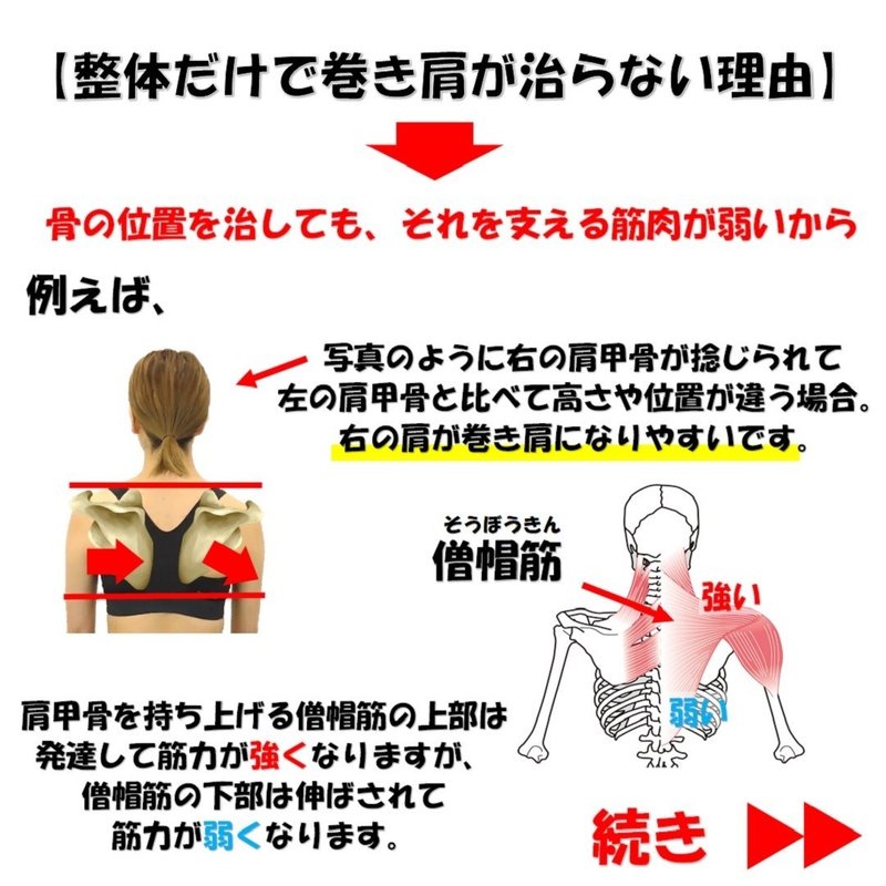肩が内側に丸まる巻き肩を治したい 原因と矯正体操のやり方5選 Revisionginza Note 肩が内側に丸まる巻き肩を治したい 原因と矯正体操のやり方5選 Revisionginza Note
