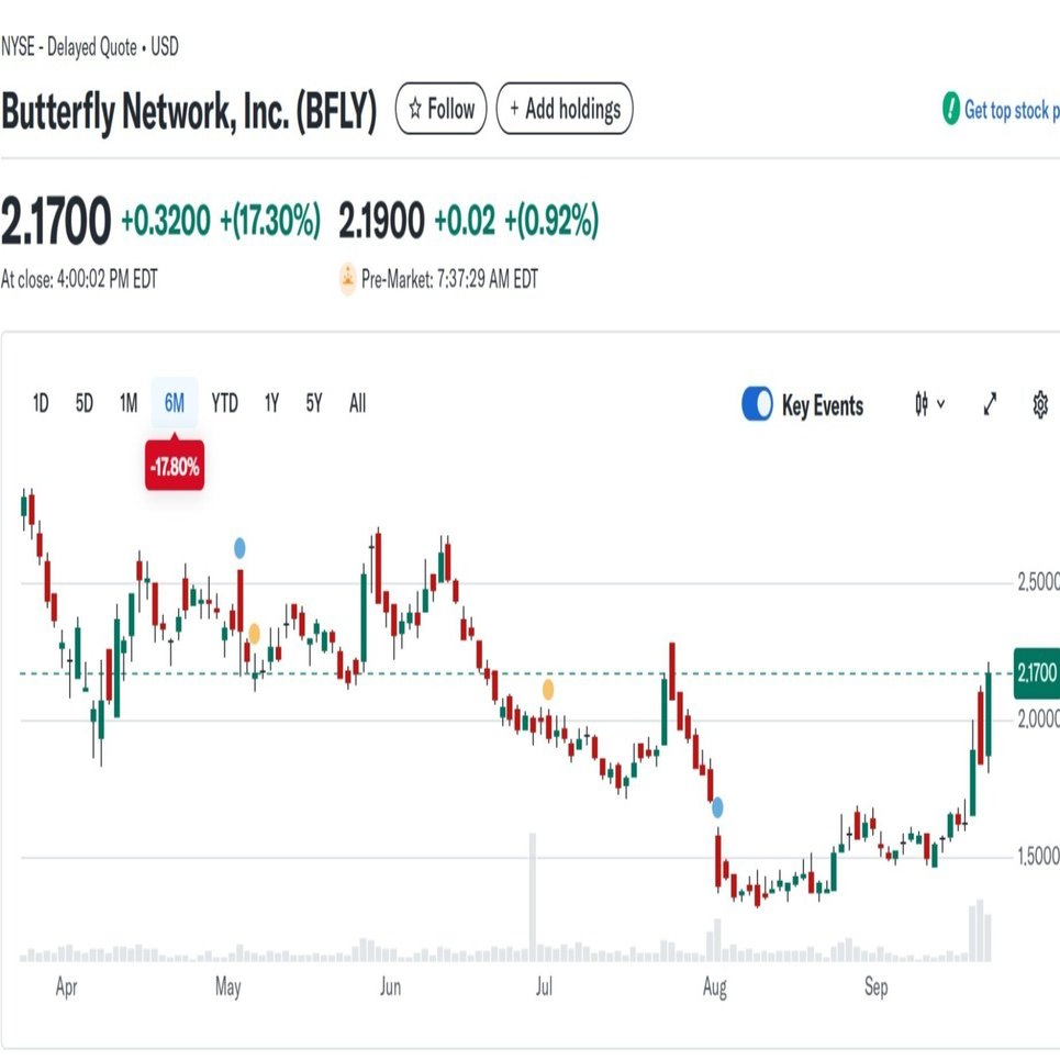 Butterfly Network, Inc.（BFLY）の株式分析(監視銘柄）｜Kino