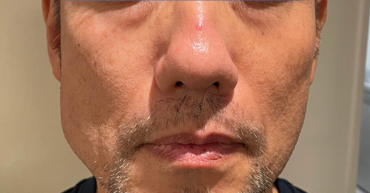 【サキナビジュー】説明書付　動作確認済み サキナ BIJOU｜フヨウサキナ