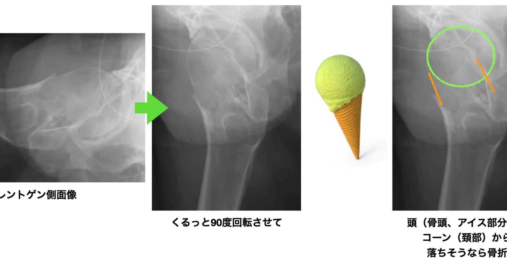 像 寿命