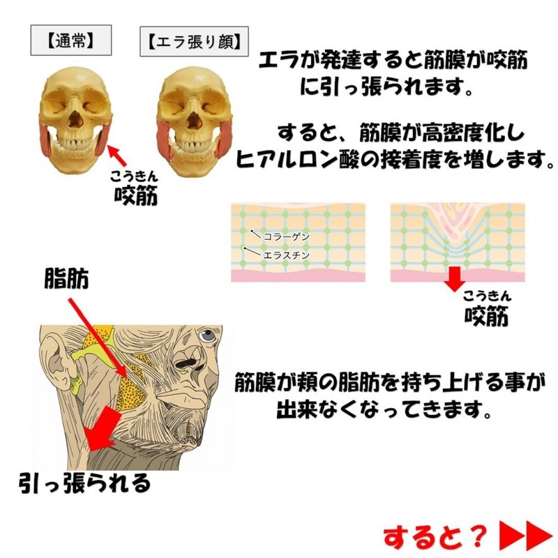 頬こけの原因と治すためのリリース矯正３選 Revisionginza Note