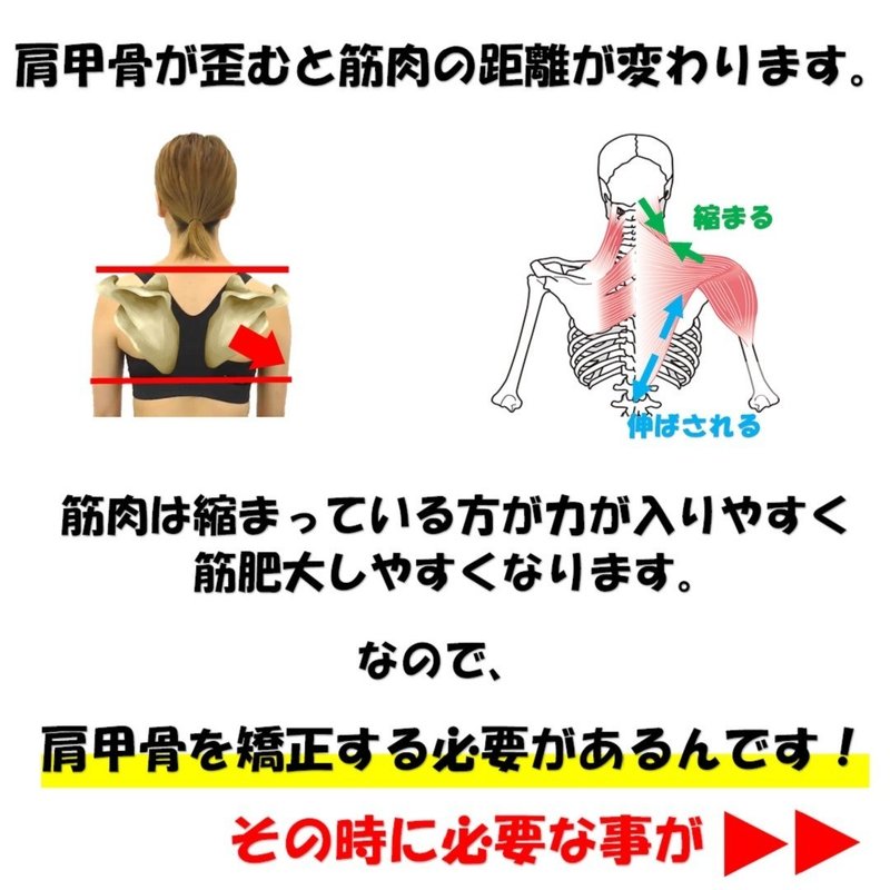 肩の筋肉の盛り上がりを無くすには 鎖骨 肩甲骨 僧帽筋 上腕三頭筋を整えると良い理由とそのやり方 Revisionginza Note