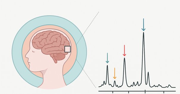 書記の読書記録#1173『ストール精神薬理学エセンシャルズ - 神経