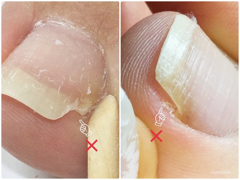 足の爪の正しい切り方 Nailsalon Sugarcane Note 足の爪の正しい切り方 Nailsalon Sugarcane Note