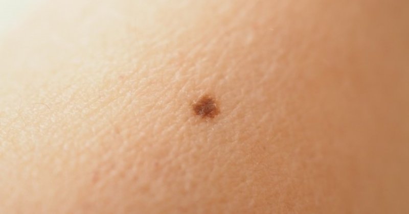 マンコに ほくろ ある女性 めっちゃ多い説 ヒモ神クズお Note