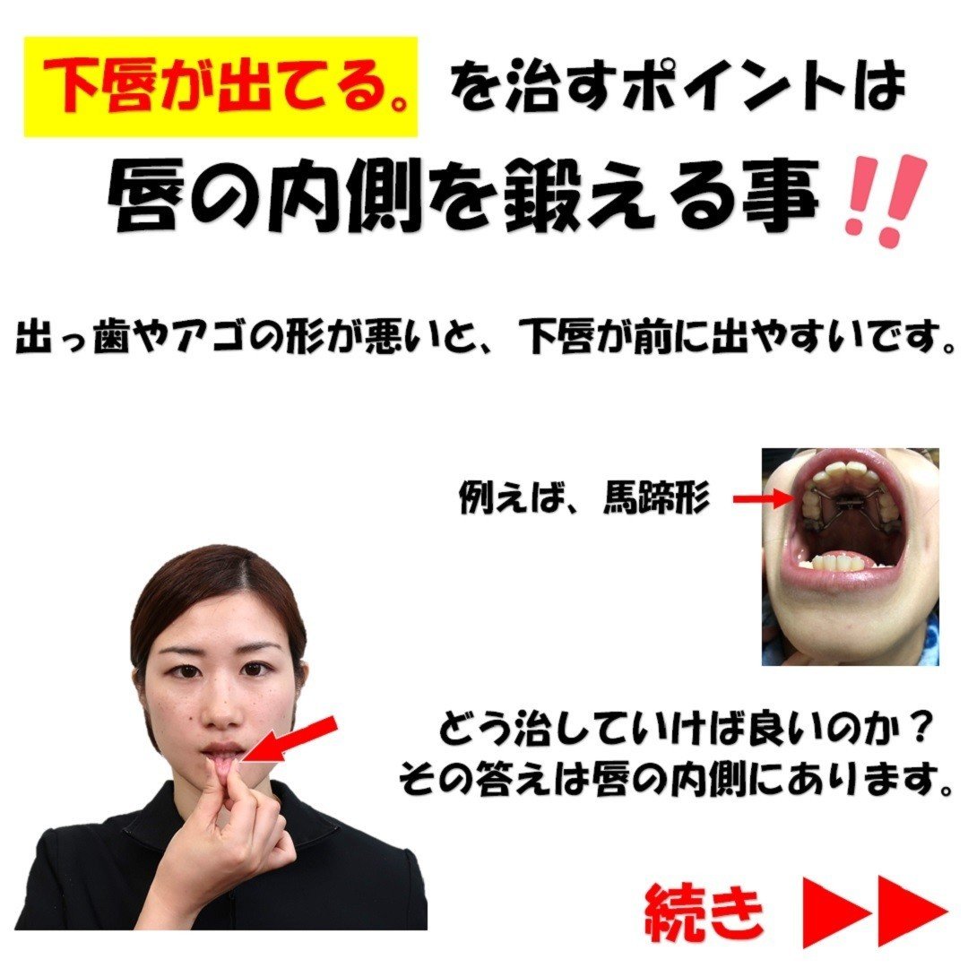 下唇が出てる を治すポイントは唇の内側を鍛える事 Revisionginza Note 下唇が出てる を治すポイントは唇の内側を鍛える事 Revisionginza Note