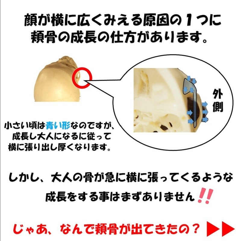 昔よりも頬骨の横張りが気になる 知っておきたい頬骨の成長と自分で出来る処置の方法 Revisionginza Note