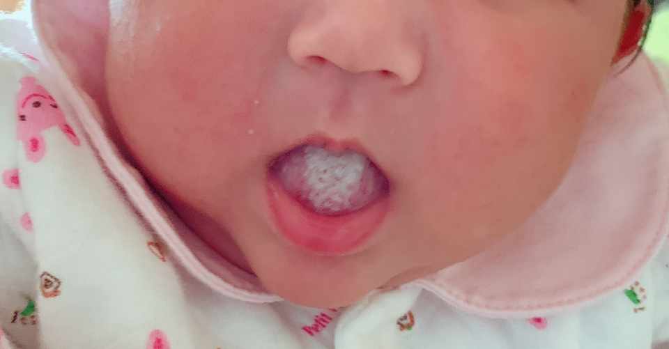 舌が白いけど大丈夫 るーたん Note