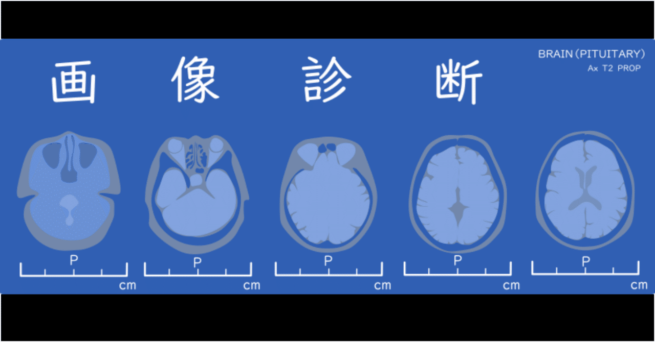 注目の10点をご紹介！『画像診断』特集 【2025年版】｜医書.jp/医学