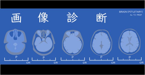 Dr.森の腹部超音波診断パーフェクト2　超音波検査士　腹部エコー Dr 森の腹部超音波診断パーフェクト premium movie version 改訂