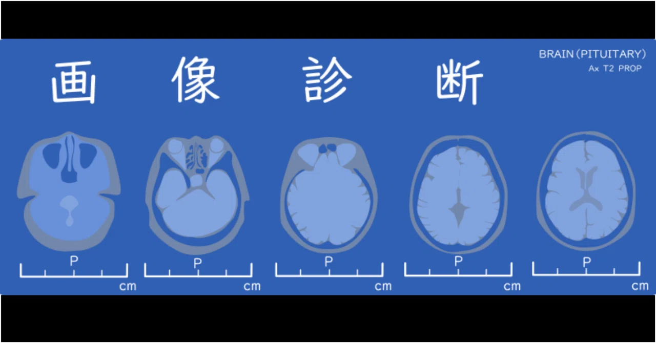 注目の10点をご紹介！『画像診断』特集 【2025年版】｜医書.jp/医学