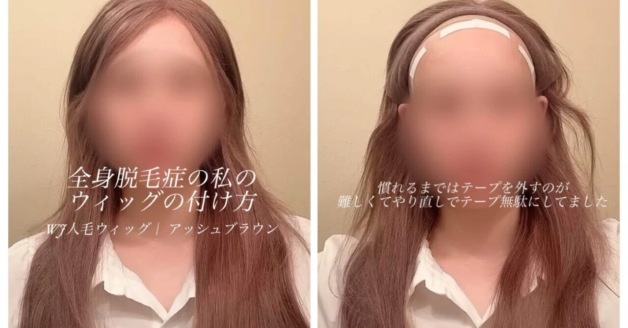 全身脱毛症の私が愛用するウィッグのつけ方】 レースフロントだから