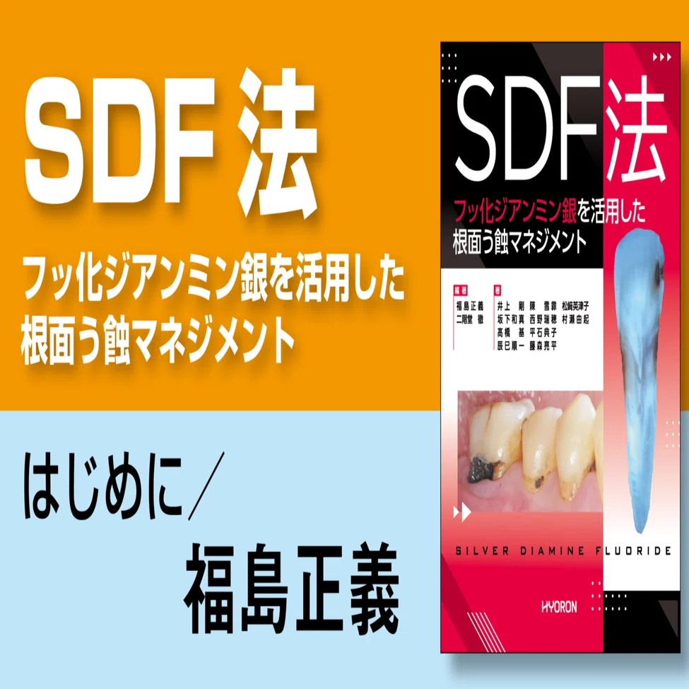 SDF法 : フッ化ジアンミン銀を活用した根面う蝕マネジメント 書評『SDF法―フッ化ジアンミン銀を活用した根面う蝕マネジメント