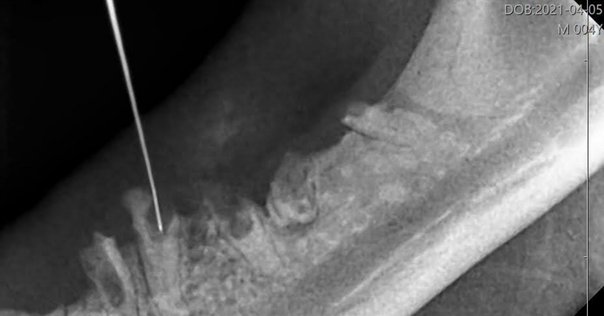 書評『インプラント時代に見直す歯根膜の活用 歯の自家移植を