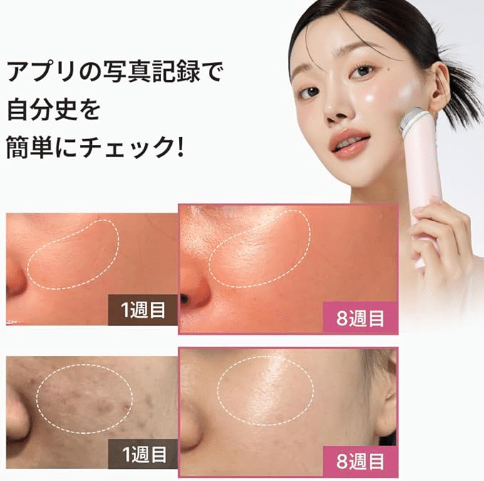 人気急上昇】メディキューブAGE-Rブースタープロで韓国美肌体験