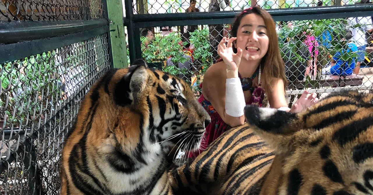 [Tragedy] It wasn't just my teeth I lost in the accident｜Miss.A