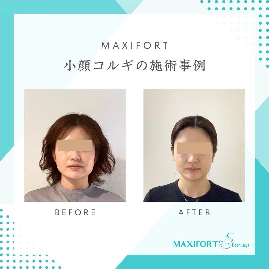 きれいになる人と、きれいを届ける自分。どちらも輝く毎日をつくりませんか?|名古屋小顔サロン|マイナス5キロ顔屋さん<MAXIFORT>