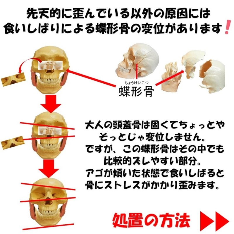 目の高さの違いなどの顔の歪みはなぜ起こる Revisionginza Note